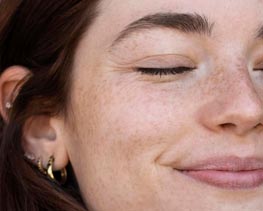 haarentfernung hannover,beauty,akne,behandlung,krampfadern,besenreiser,cellulite,couperose,dehnungsstreifen,pigmentflecken,poren,verjuengung,falten,haut,haare